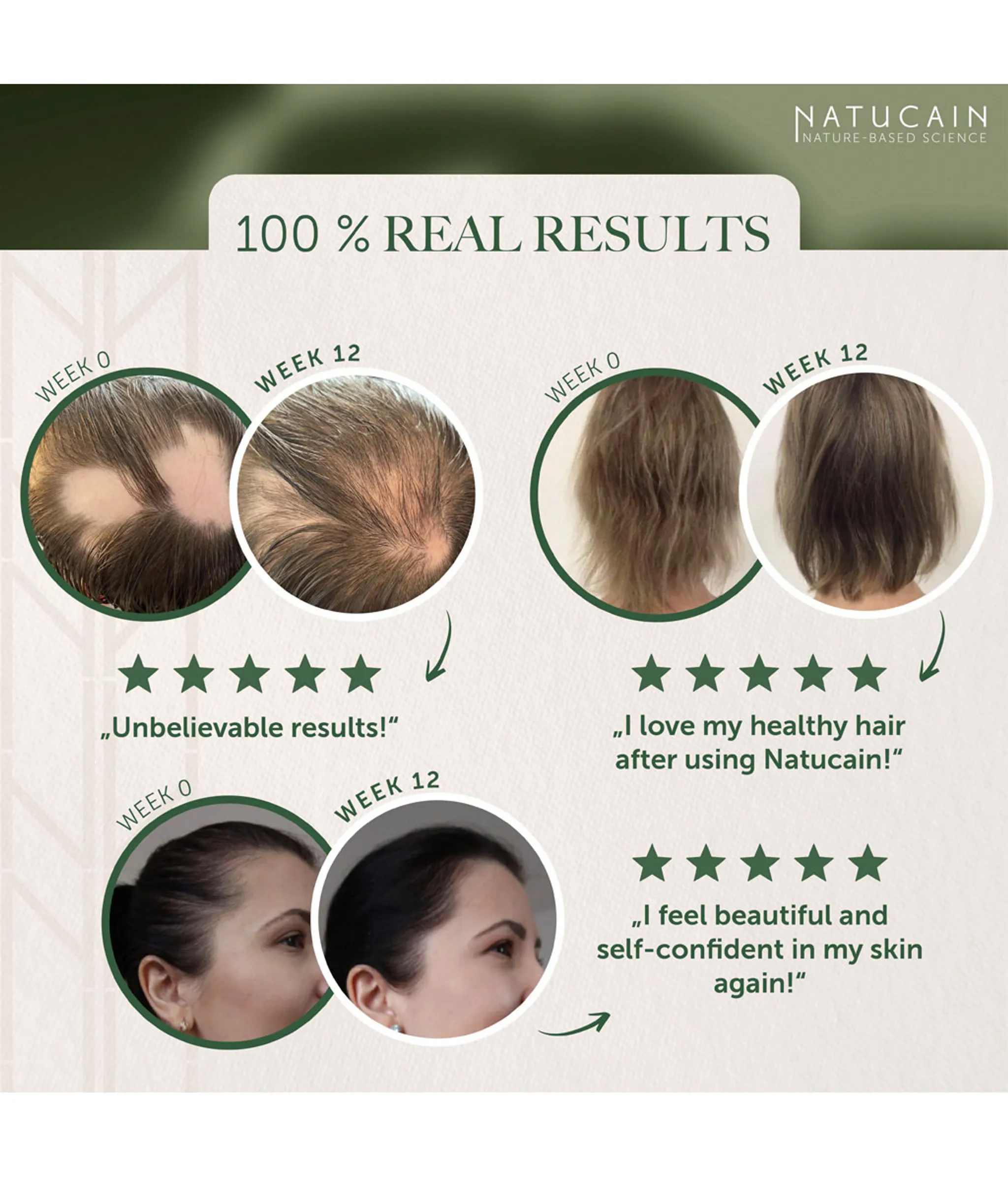 Natucain Hair Activator 200ML